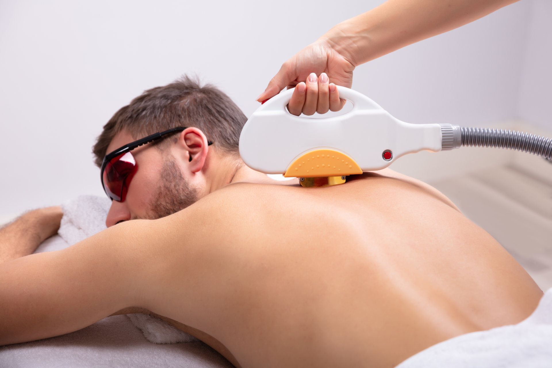 Alma Laser Behandlung