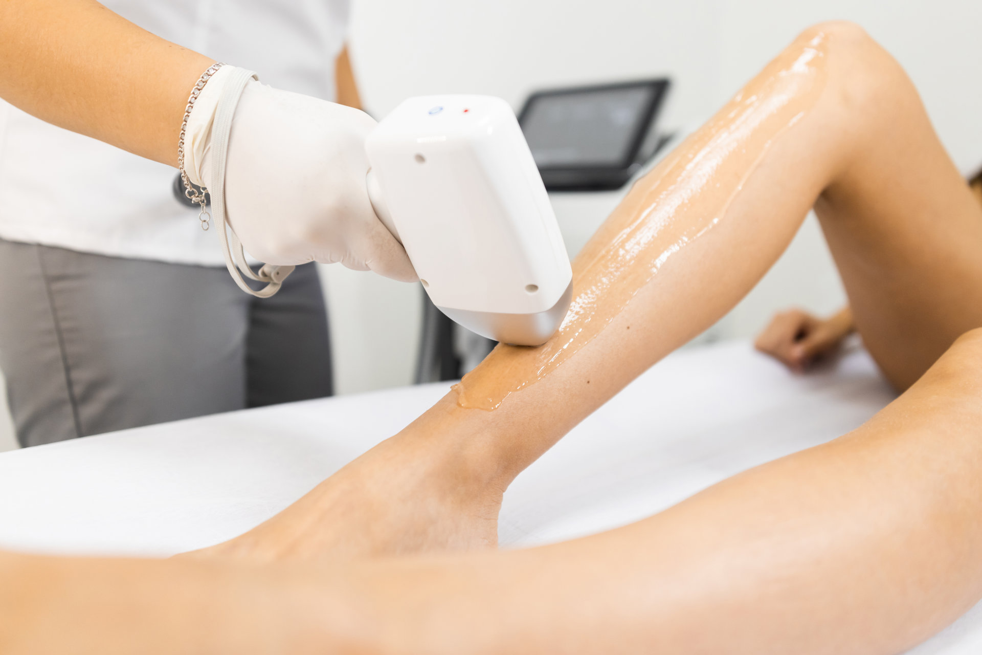SHR Haarentfernung bei Beauty By Lenz